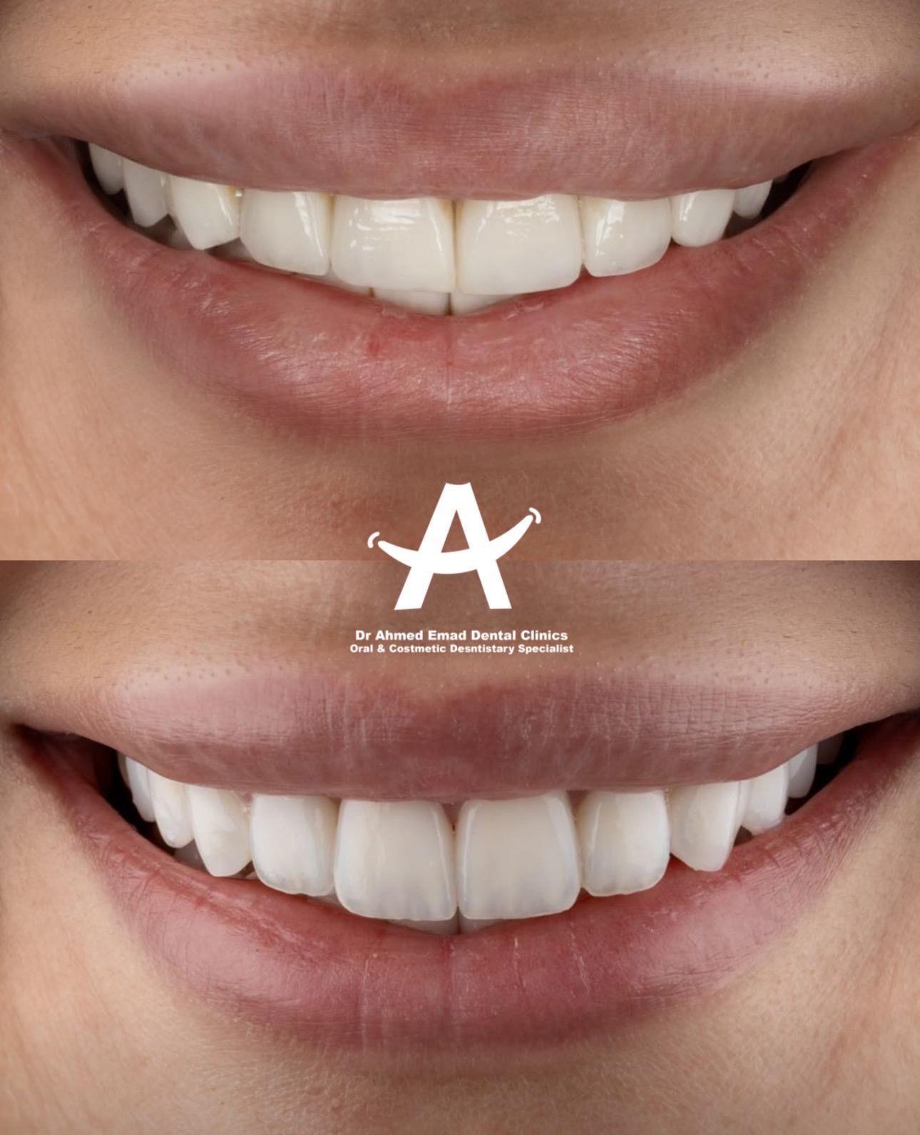 Selected dental treatment result